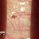 Image for article titled Tick Lodged on Kentucky Man's Eyeball Made 'Popping Sound' When Doctor Pulled It Off